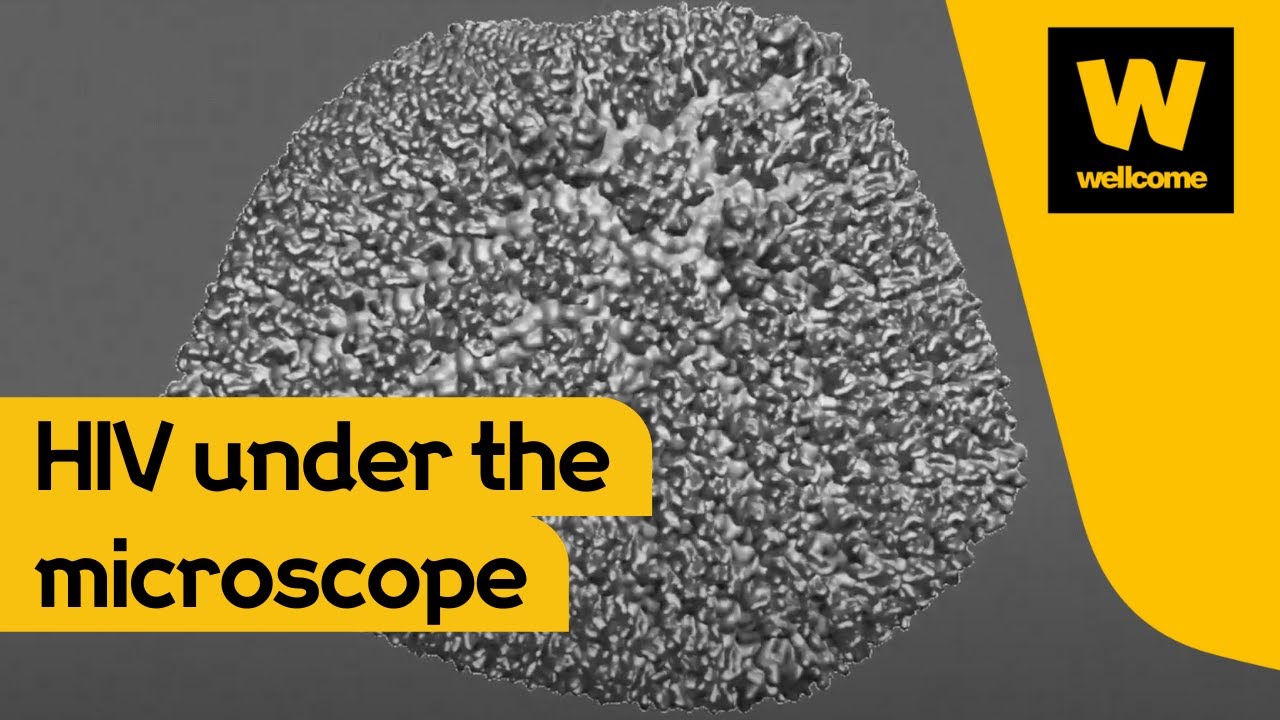 How a super-microscope could revolutionise what we know about HIV | Wellcome