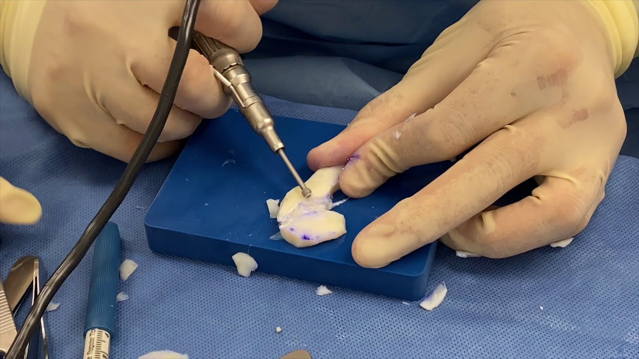 Microtia Cadaveric Ear Carving  Video (Prior to Implantation). Rib Ear Reconstruction without Pain