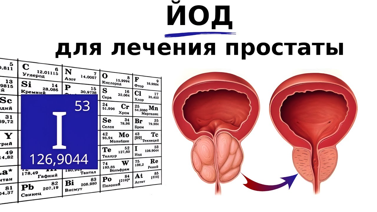Хронический ПРОСТАТИТ. Что делать, если не помогают Антибиотики, свечи и массаж простаты