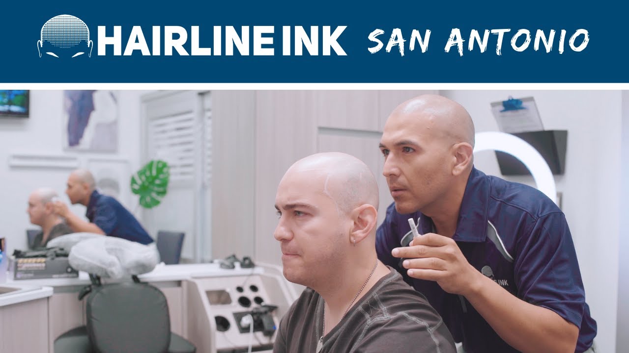 Scalp Micropigmentation (SMP) in San Antonio at Hairline Ink