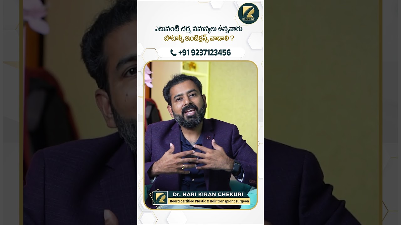 Botox Injection on Face || ReDefine Channel || 