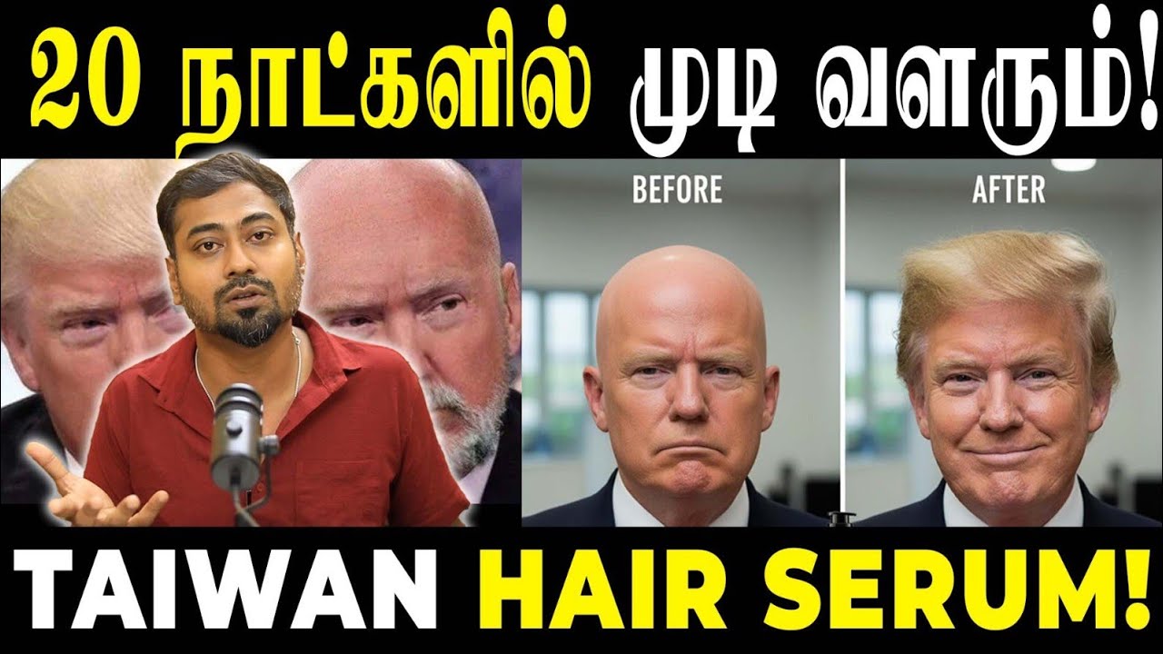 The End of Baldness? 👴🏼 - Taiwan Hair Serum | Varun Talks