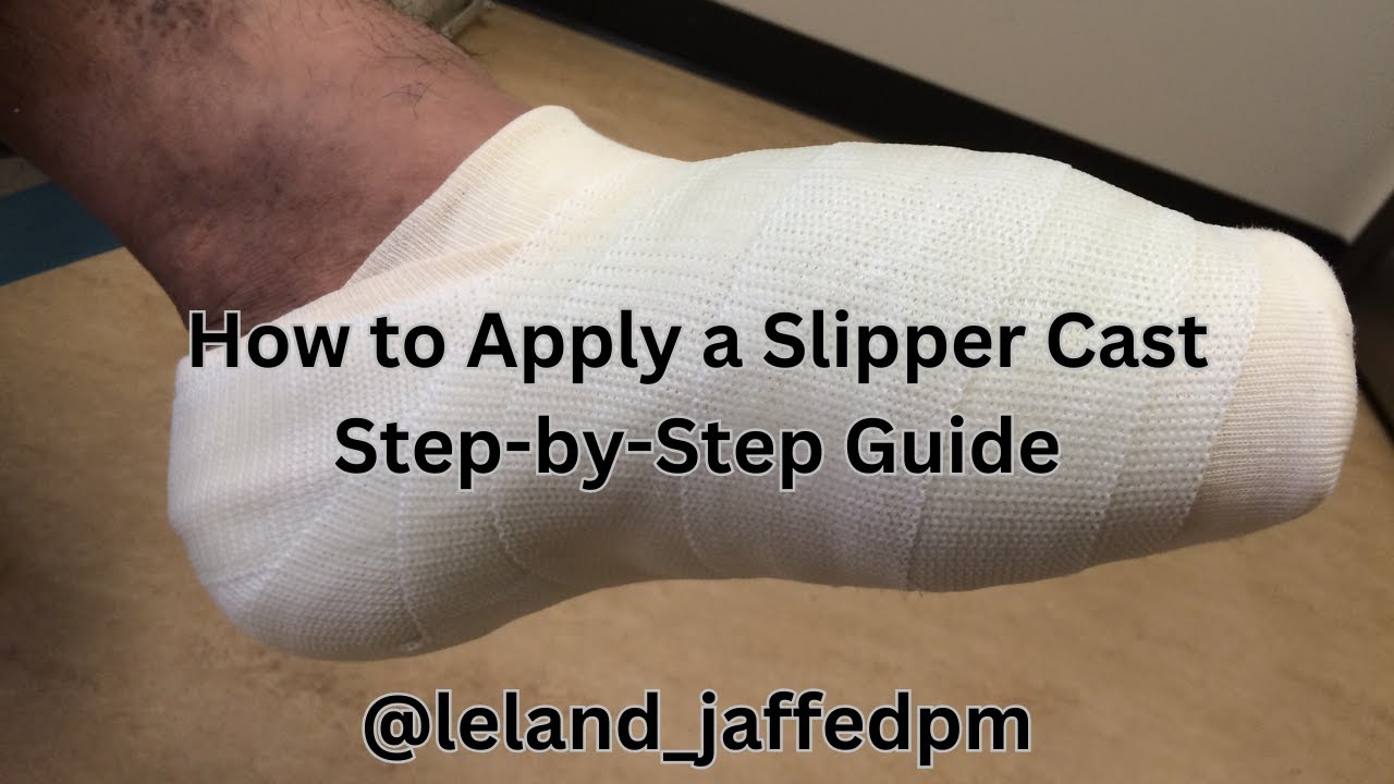 How to Apply a Slipper Cast | Step-by-Step Guide