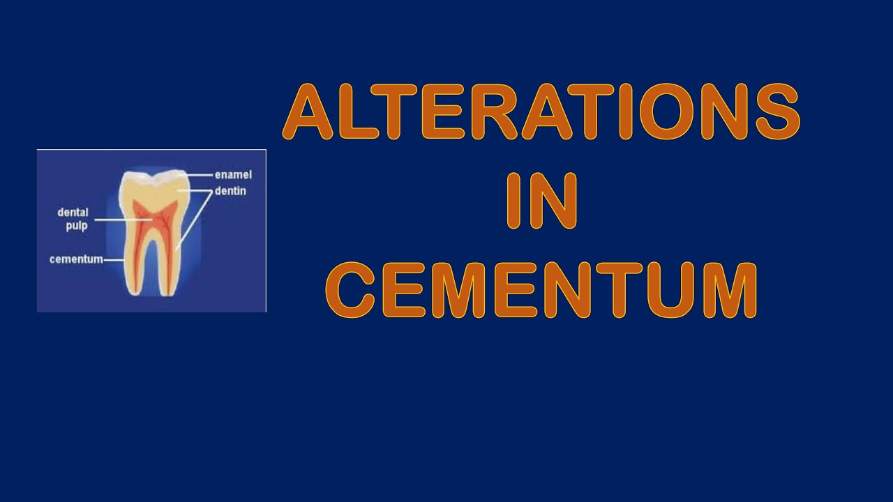 Cementum Alterations Simplified | Quick Revision for Dental Students