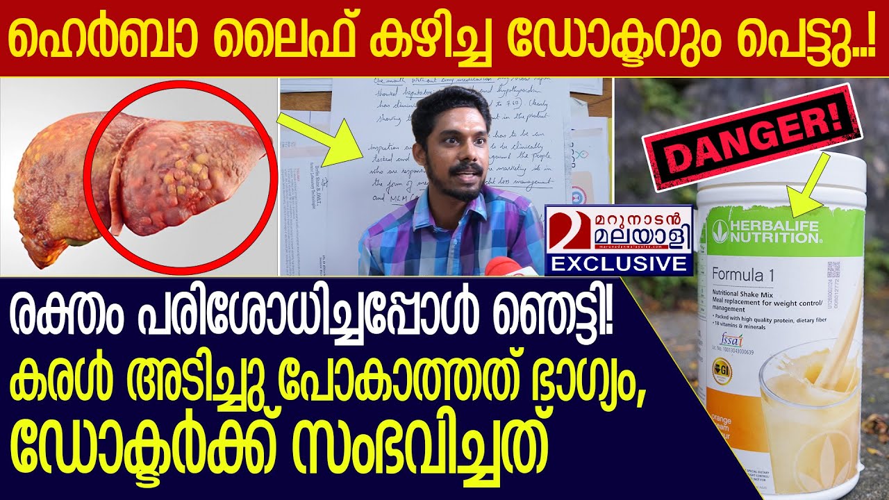 ഹെർബാ ലൈഫ് കഴിച്ച ഡോക്ടർക്ക് സംഭവിച്ചത്! കരൾ അടിച്ചു പോകാത്തത് ഭാഗ്യം  I  Herbalife Nutrition Food