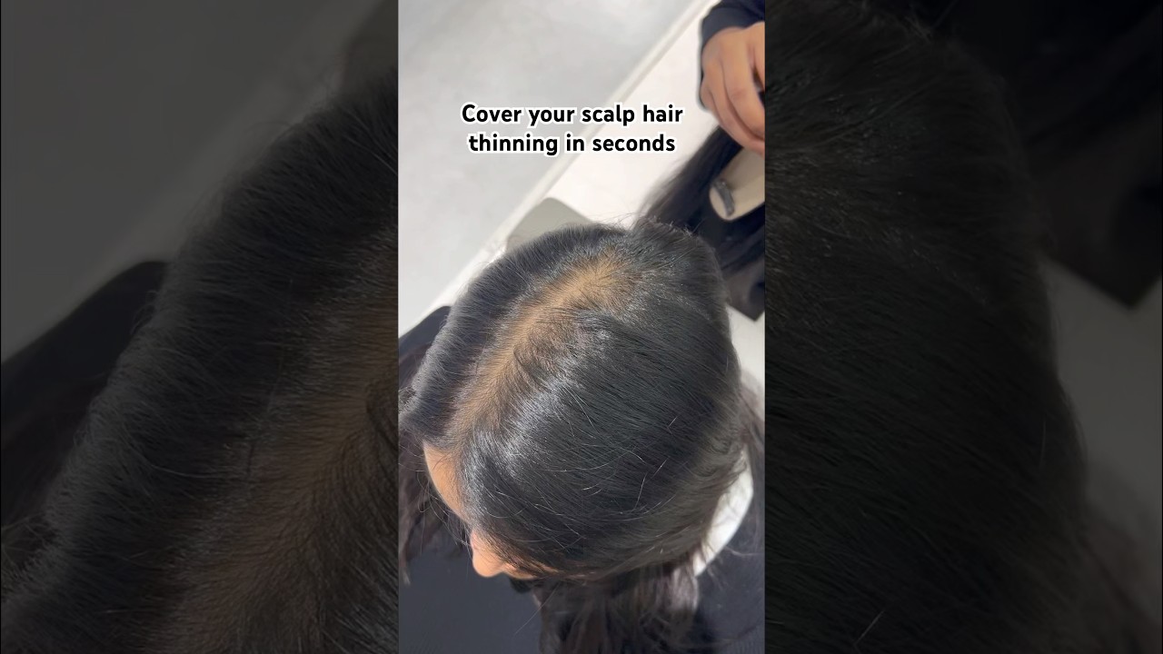 Extremely natural looking hair topper for scalp coverage. 