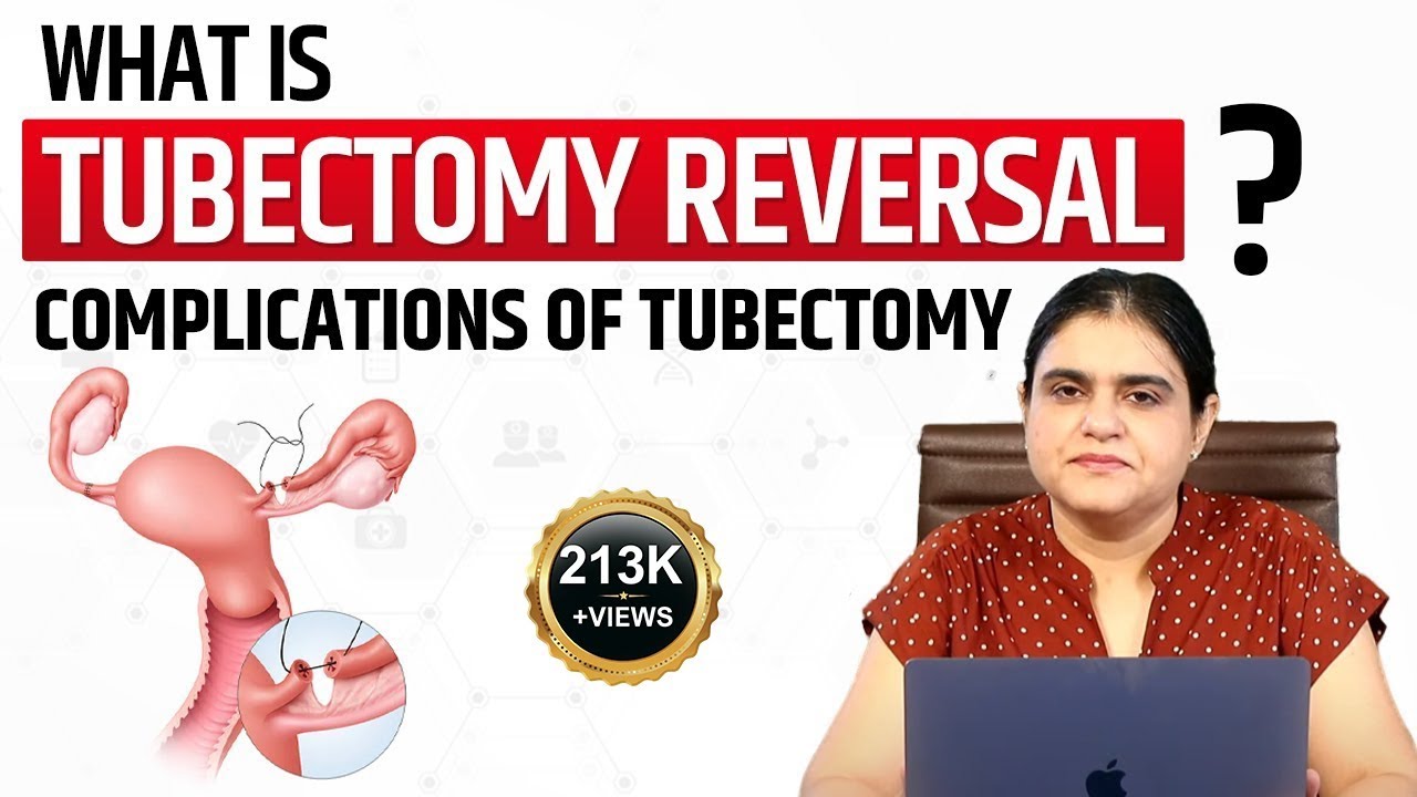 Tubectomy can be reversed?, Problems, Methods, Surgery, | Kya Mahila Nasbandi Khul Sakti Hai