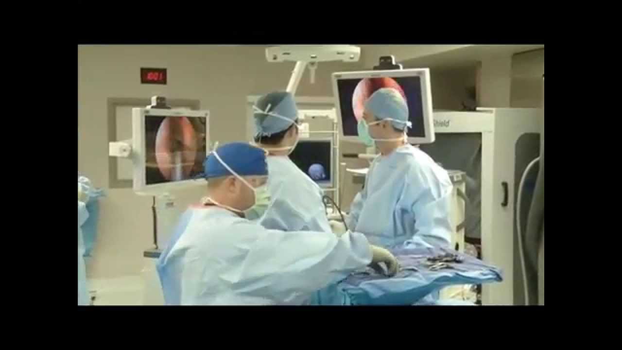 Robotic Endonasal Skull Base Surgery With Tentacle-Like Manipulators