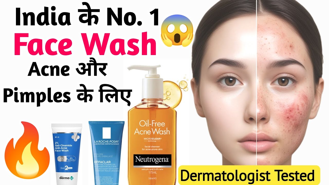 Top 7 🔥 Best Face Wash for Acne and Pimples in India | एक्ने और पिंपल के लिए India's No. 1 फेस वॉश