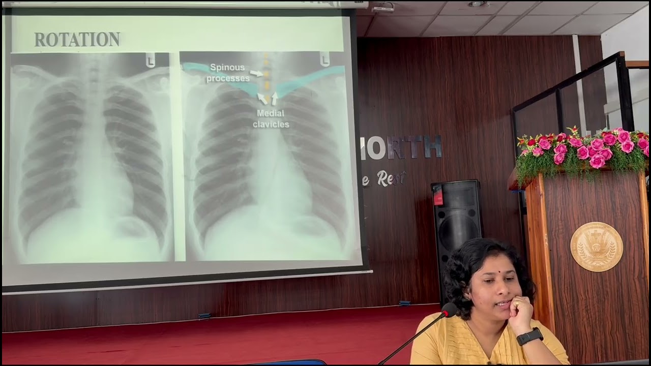 FUNDAMENTALS CHEST XRAY