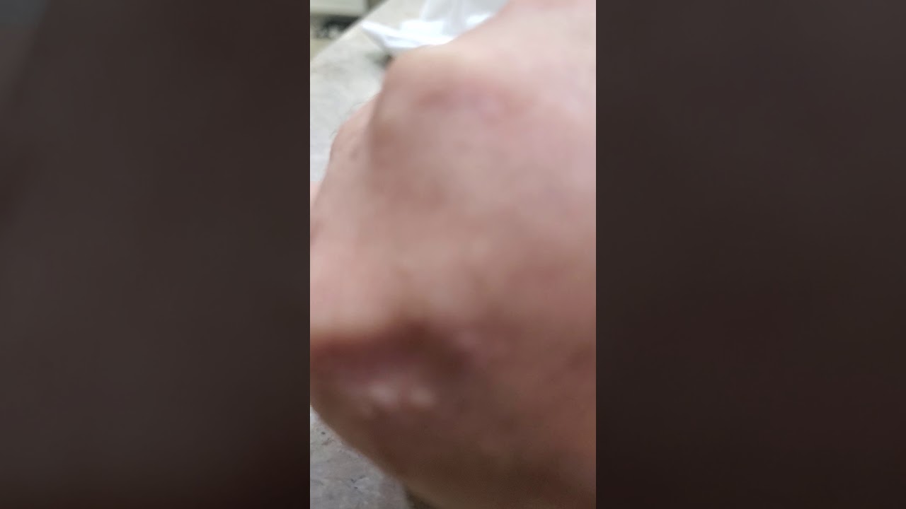 voopoo rta issue