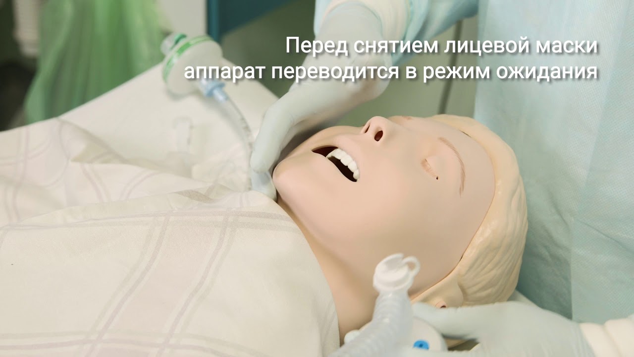 Интубация трахеи