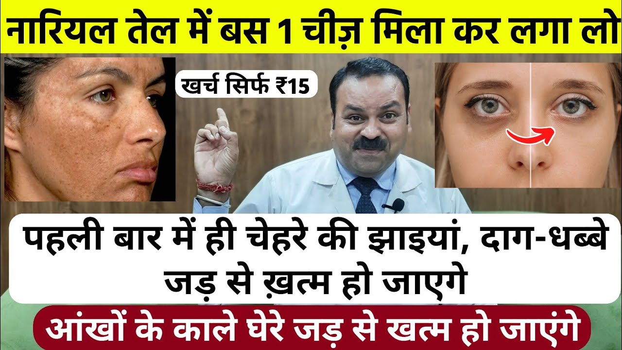 आंखों के काले घेरे, चेहरे की झाइयां, दाग-धब्बे जड़ से ख़त्म होगे बस रात को लगा कर सो जाओ Dark Circles