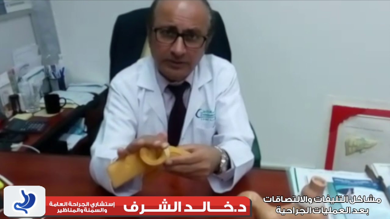 مشاكل التليفات أو الالتصاقات بعد العمليات الجراحية ج1