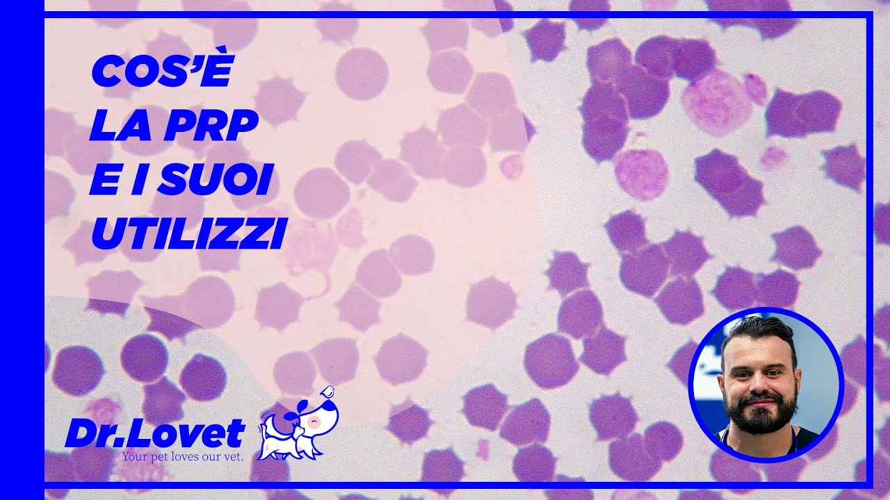 Il PRP (plasma arricchito in piastrine): Cos'è? A cosa serve?  Quando utilizzarlo? Benefici.