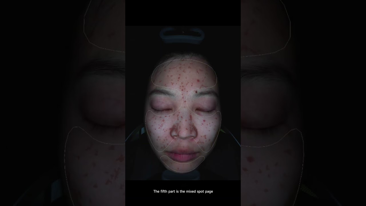AI Intelligent skin analyzer B3 operate video
