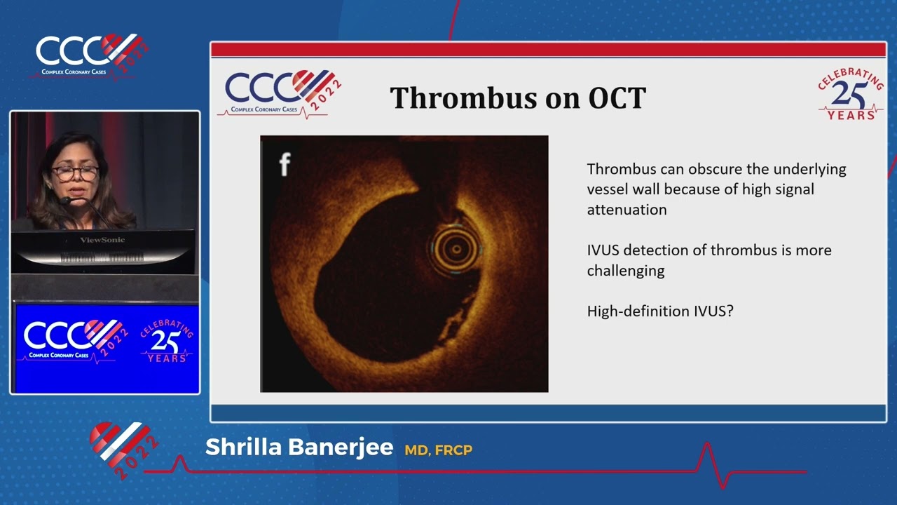 Intrav. Imaging in MINOCA: When to Use Index of Microcirculatory Resistance IMR- Shrilla Banerjee MD
