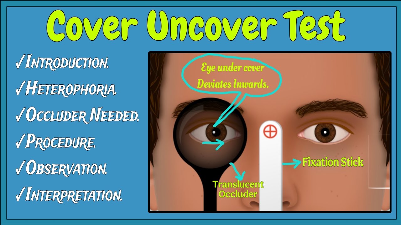 Cover Uncover Test- A complete Tutorial (#covertest #optometry)