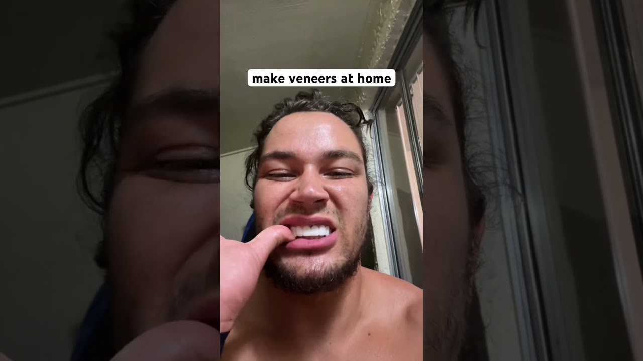 how to make veneers at home #diy