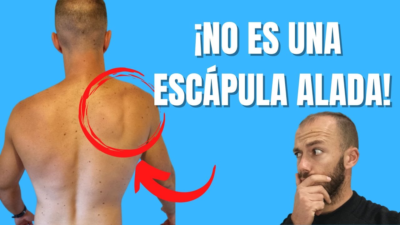 ⚠️¿Tienes escápula ALADA o DISCINESIA escapular? CÓMO distinguirlas y su TRATAMIENTO✅