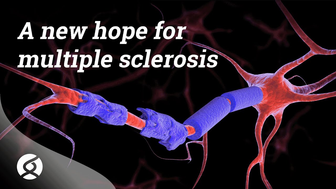 A new hope for multiple sclerosis | Public seminar