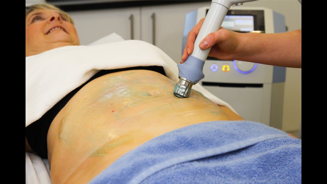 Shockwave Therapy | BTL X-Wave | Cellulite Treatment | Fat Reduction