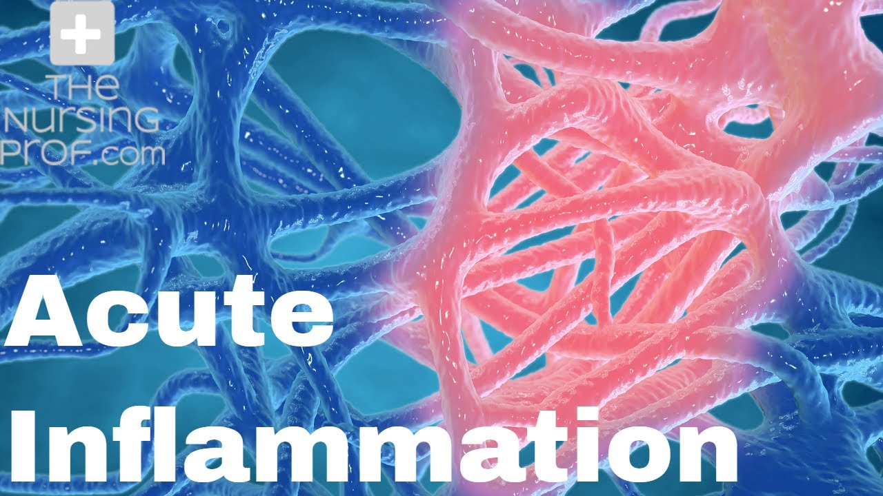 Acute Inflammation: The First Line of Defense.