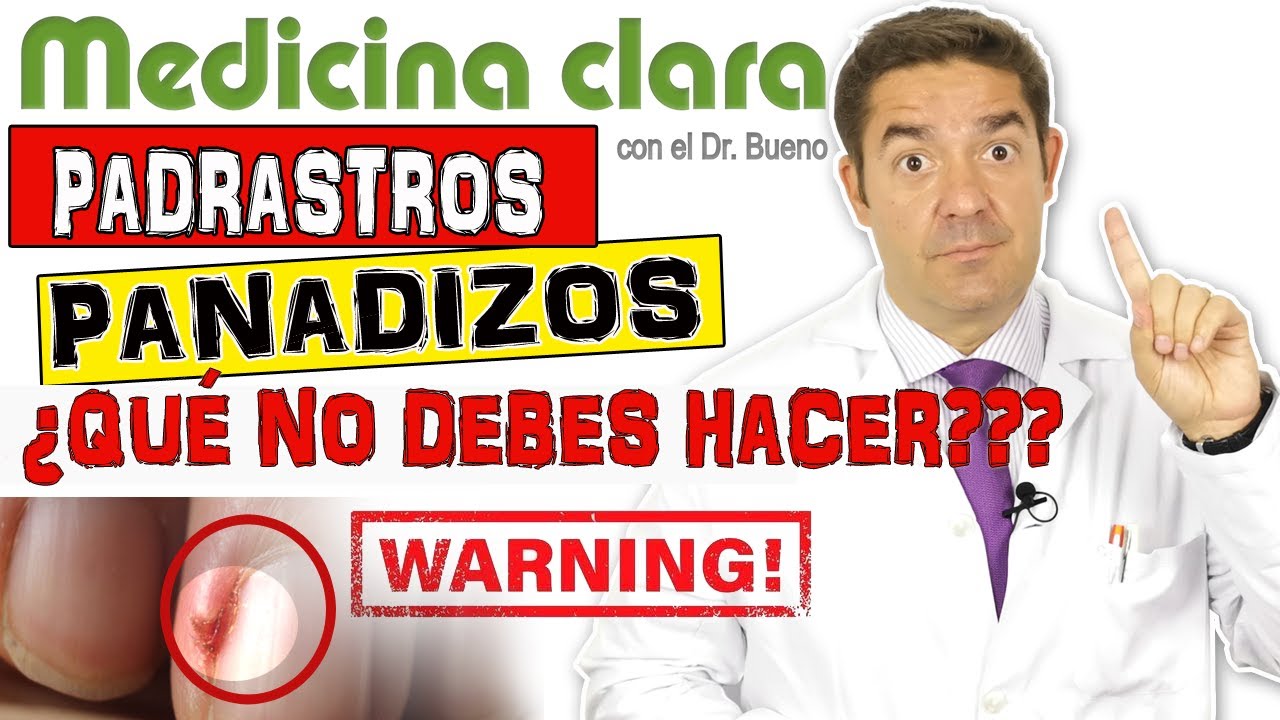PADRASTROS-PELLEJITOS &iquest;C&Oacute;MO QUITARLOS CORRECTAMENTE?  | Medicina Clara