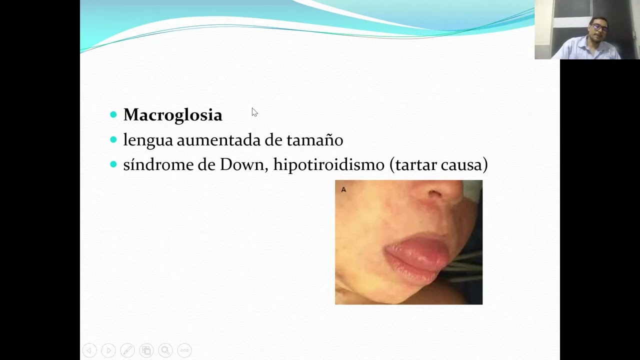 PATOLOGIA ORAL
