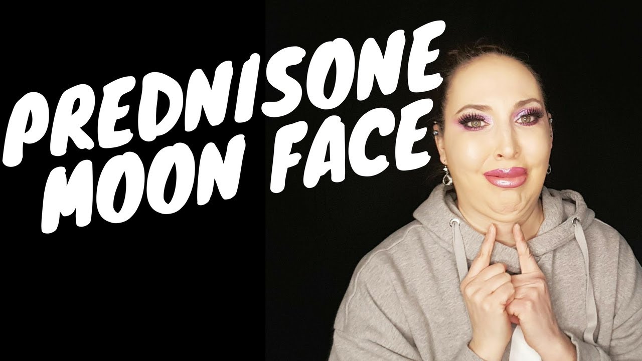 Prednisone MOON FACE :(