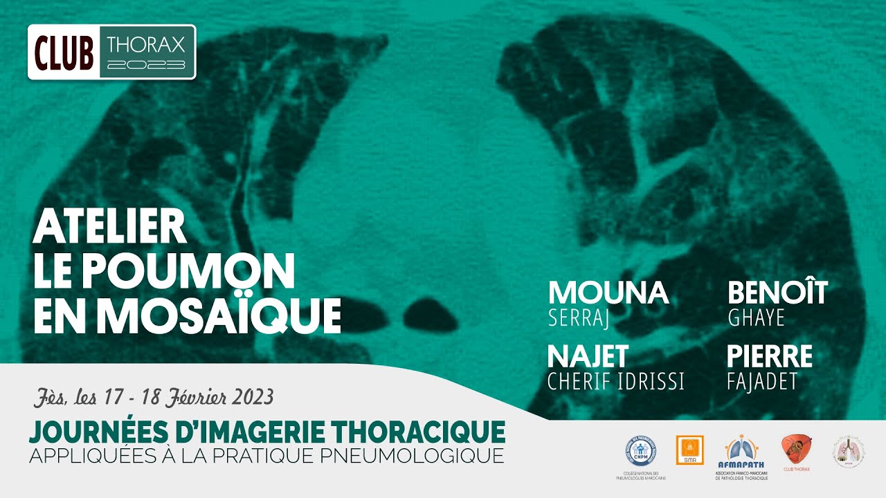 Atelier Poumon en Mosaique