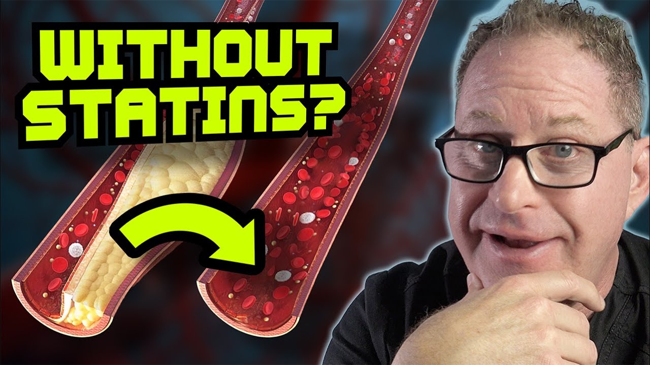 How to Lower Cholesterol without Statins - Doctor's Analysis