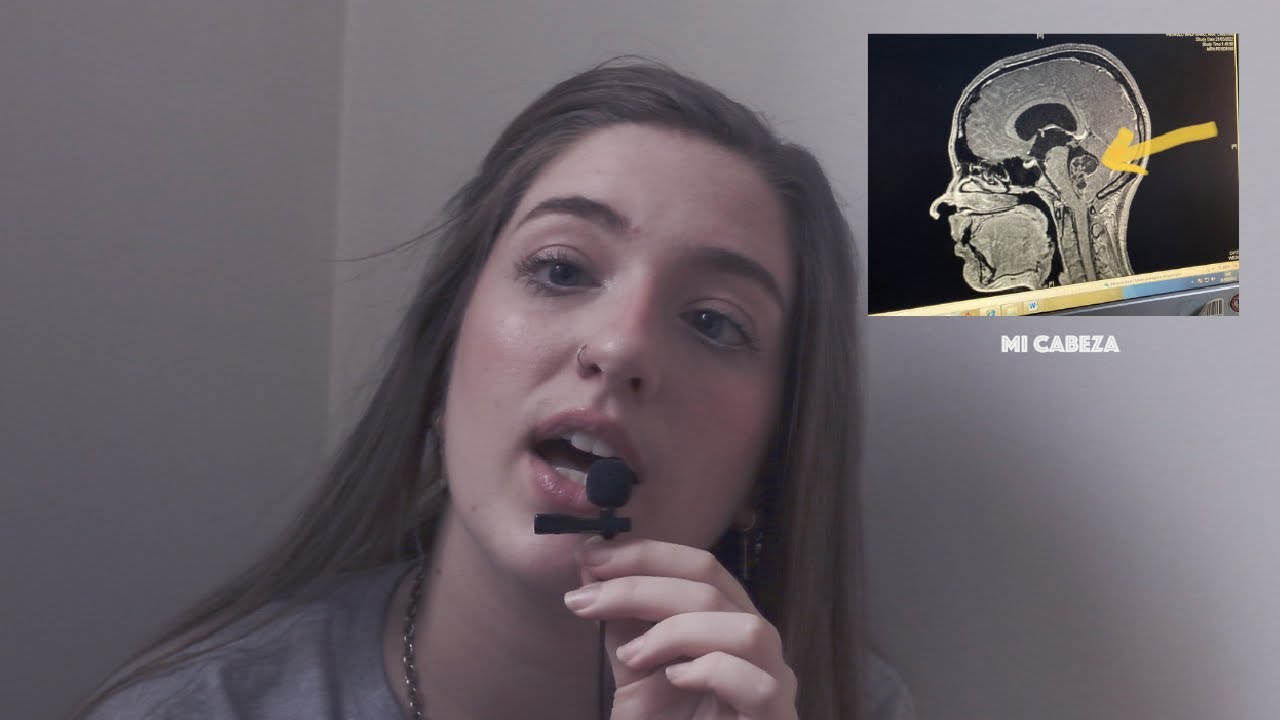 Me diagnosticaron un tumor en el cerebro