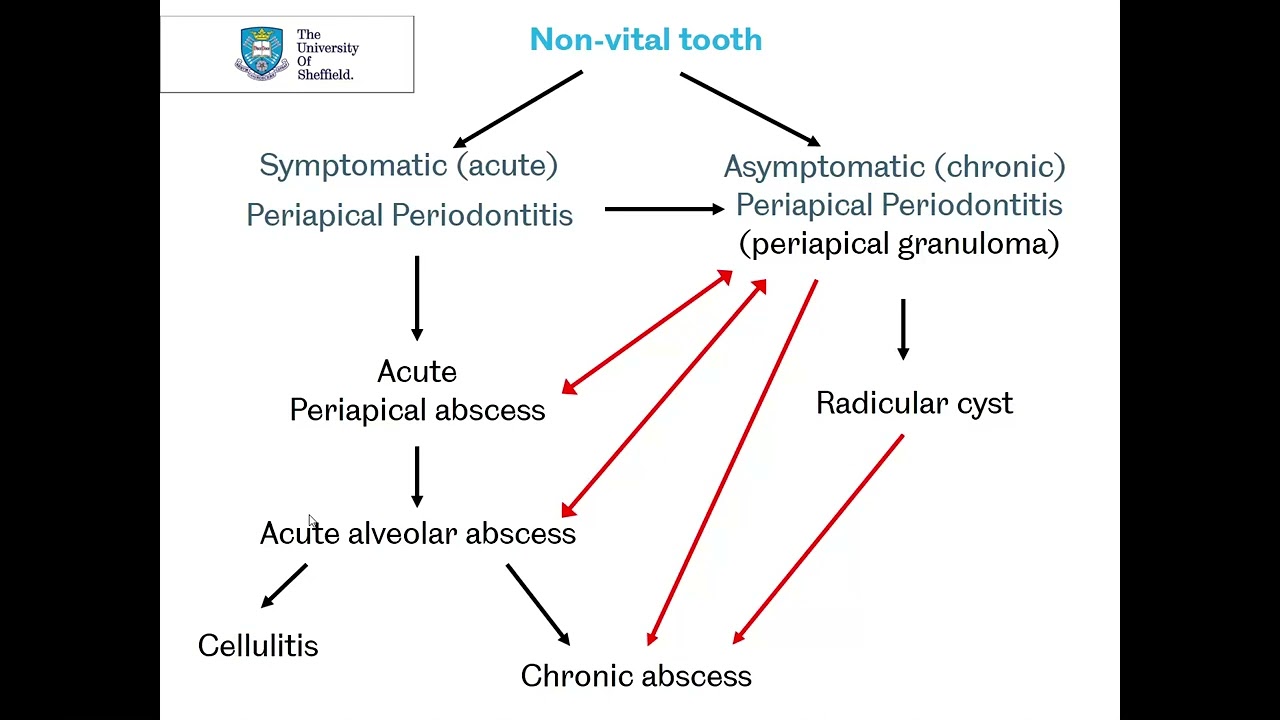 Periapical pathology Part 1