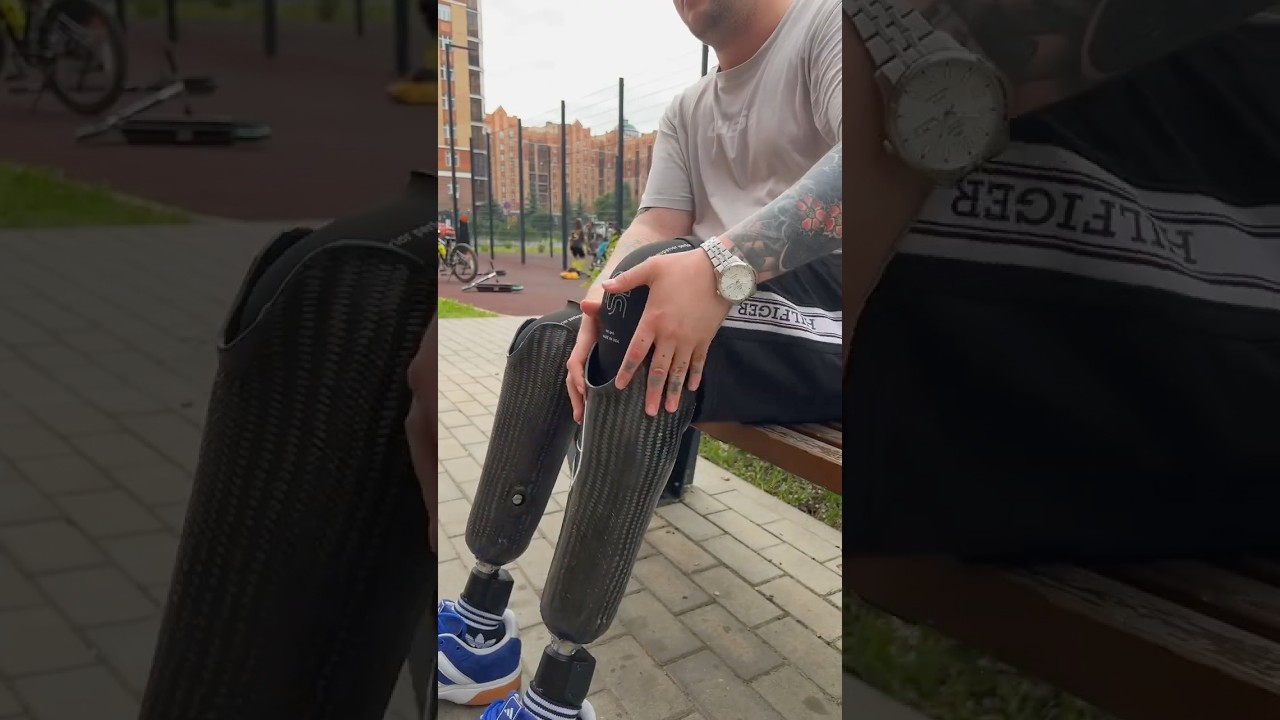 Как правильно ходить на протезе? #протезноги #протезирование #протезированиеконечностей