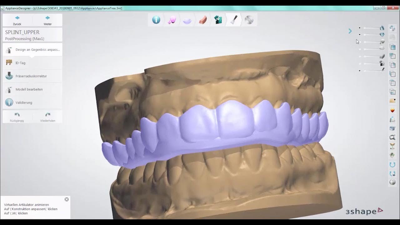 Tutorial - CAD einer Oberkieferschiene