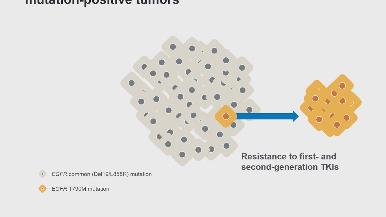 Tumor clonality in EGFR mutation-positive NSCLC