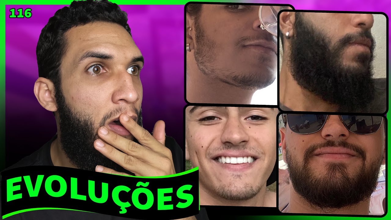 EVOLUÇÕES COM MINOXIDIL - BARBA ANTES E DEPOIS #116