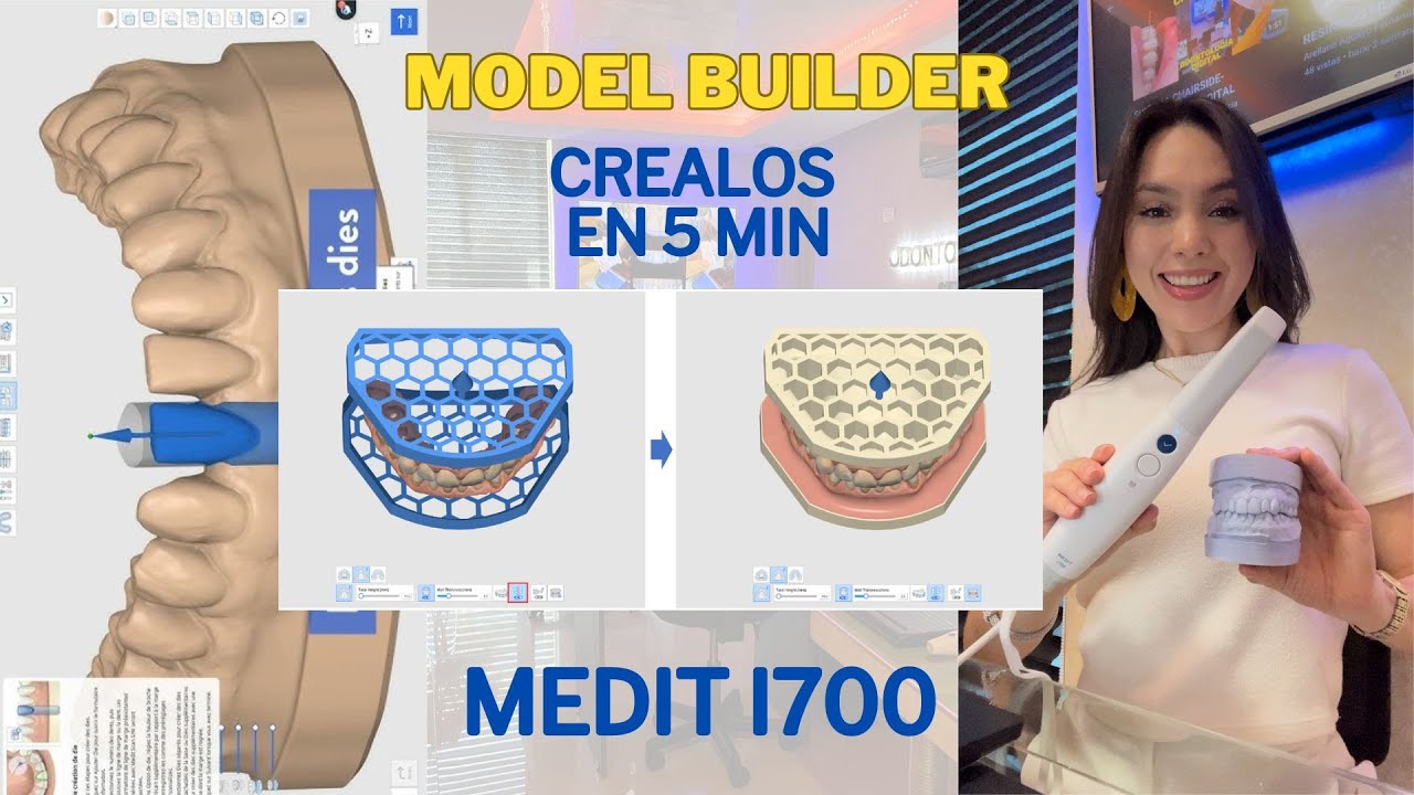 CREADOR DE MODELO MEDIT- MODEL BUILDER