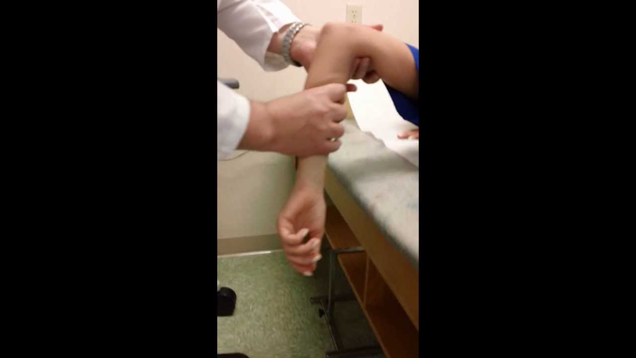 Posterior Elbow Dislocation & Reduction