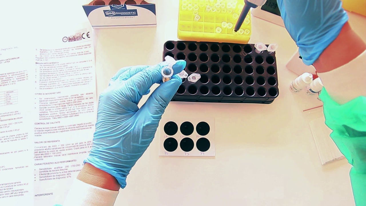 Determination of anti-streptolysin O (ASLO) by agglutination method (LATEX)