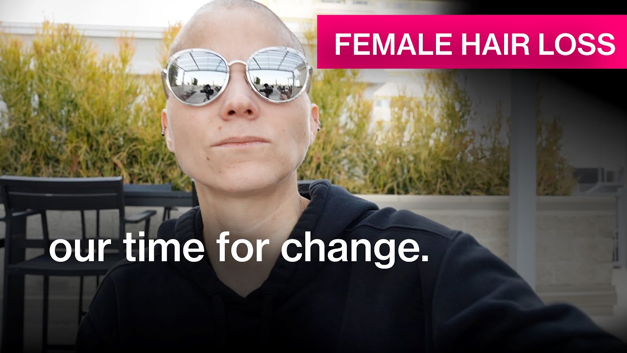 Random Thoughts on Female Hair Loss, Coming To Terms, When Is It The Right Time For Change?