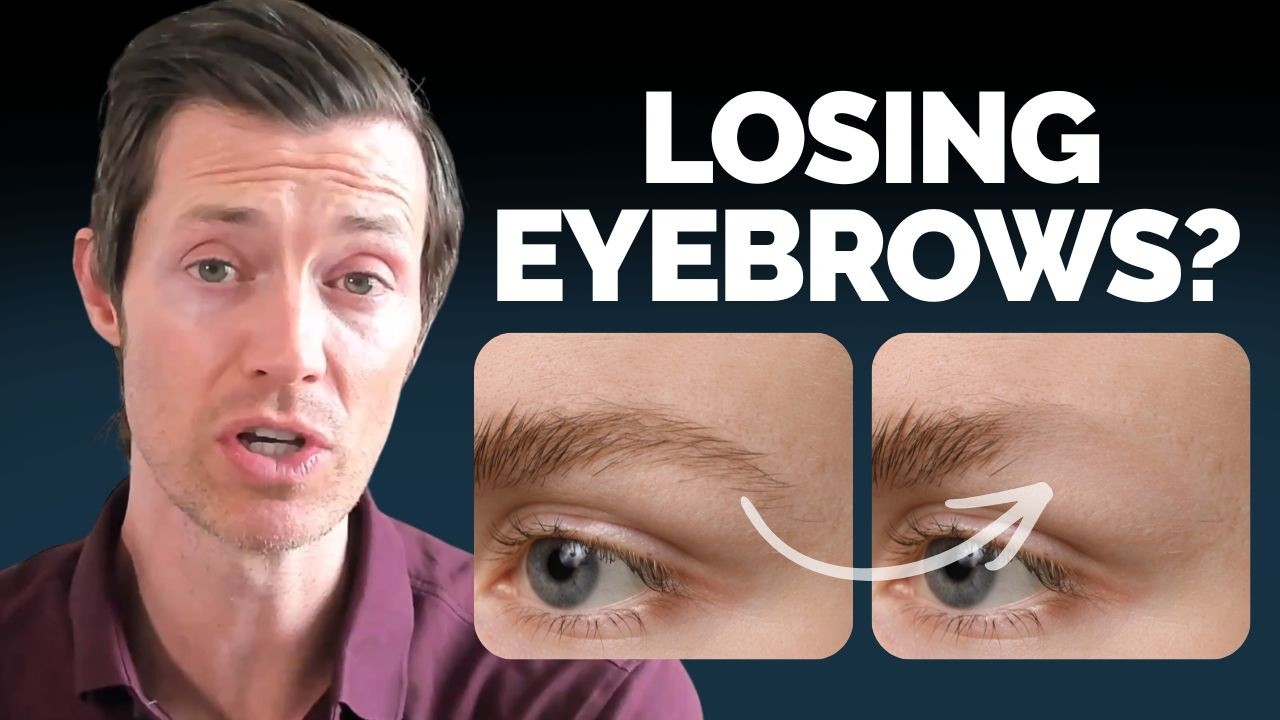 Ваша щитовидная железа вызывает у вас облысение?