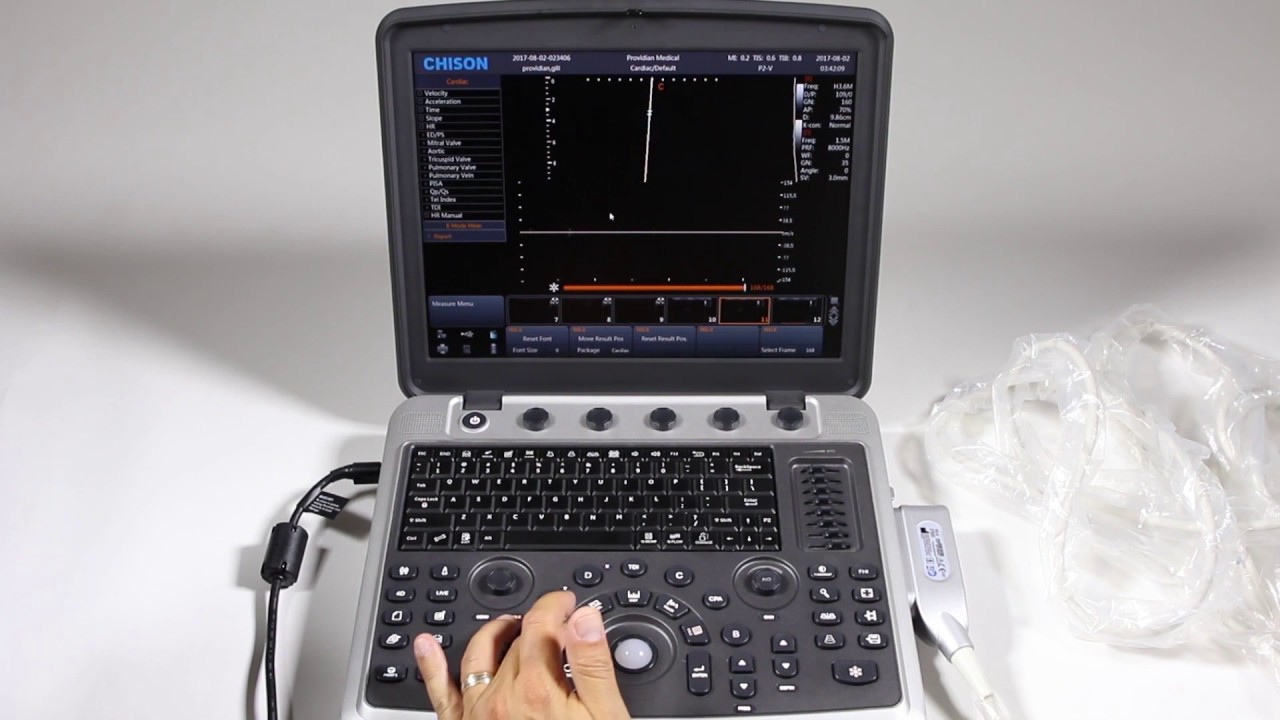 Chison SonoBook 9 Training Part 4: Calculations and Annotations