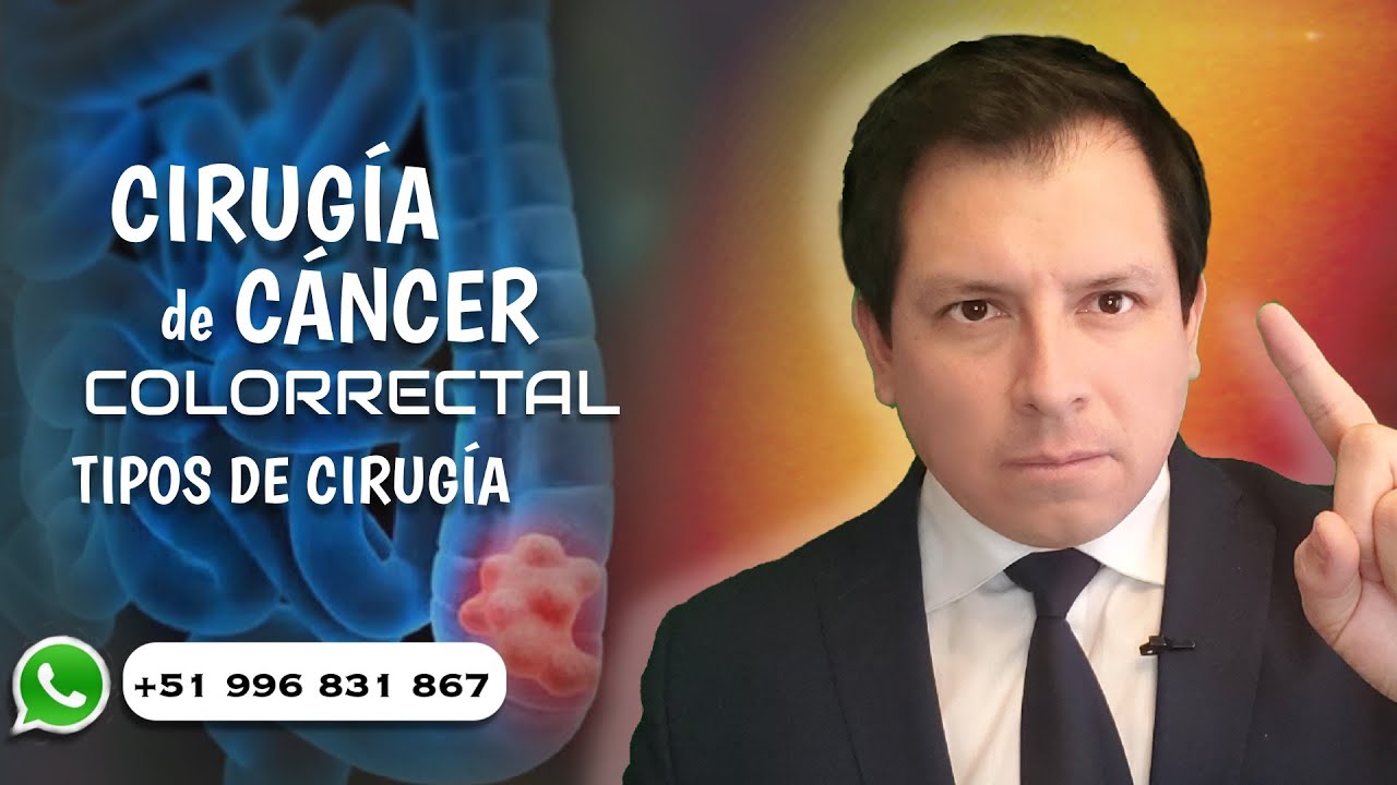 CIRUGIA CANCER DE COLON