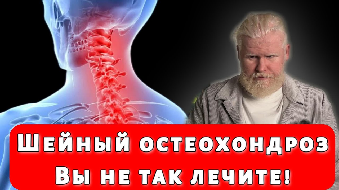 Шейный остеохондроз! Вы не так  лечите. Реальные причины о которых не говорят врачи!