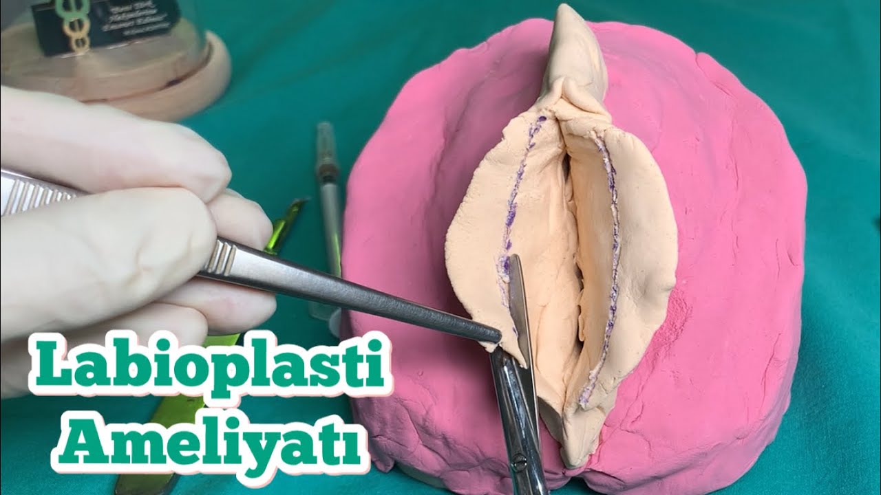 Labioplasti Ameliyatı Nedir? | Genital Estetik Nasıl Yapılır? | Vajina Estetiği İ&ccedil; Dudak Estetiği