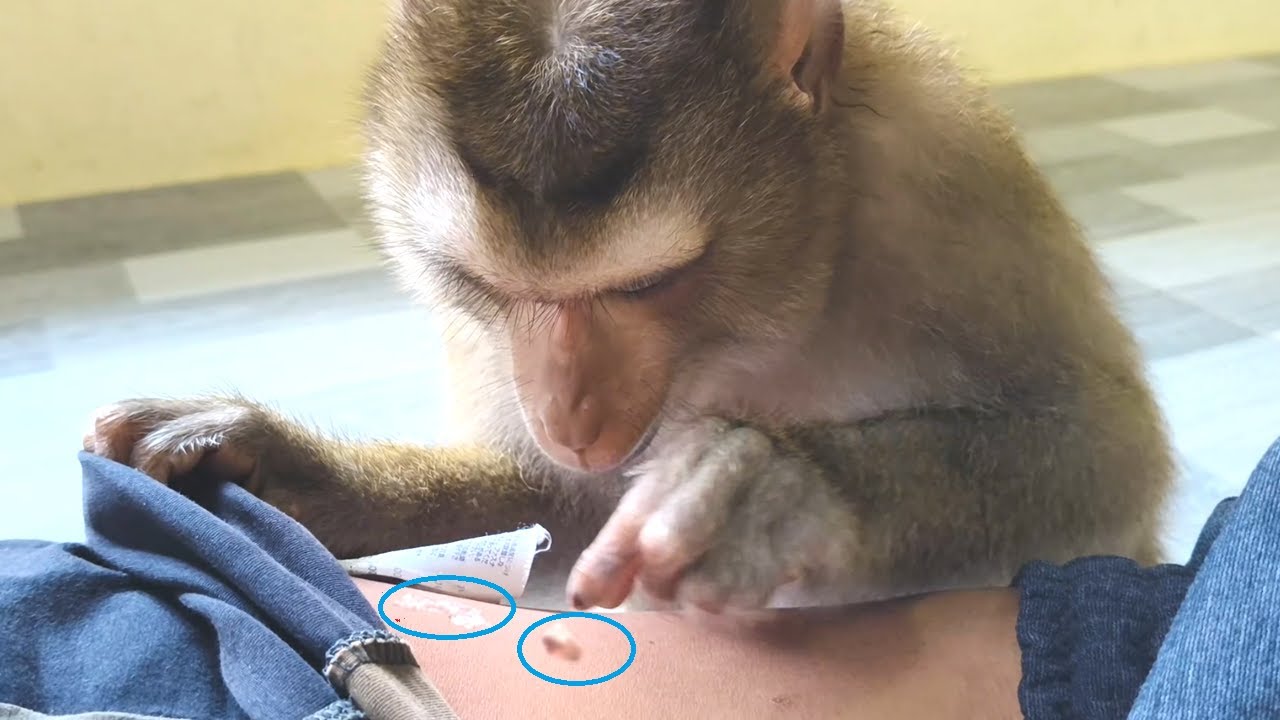 Bela Found Remove Deed cells​ on Hips Treatment