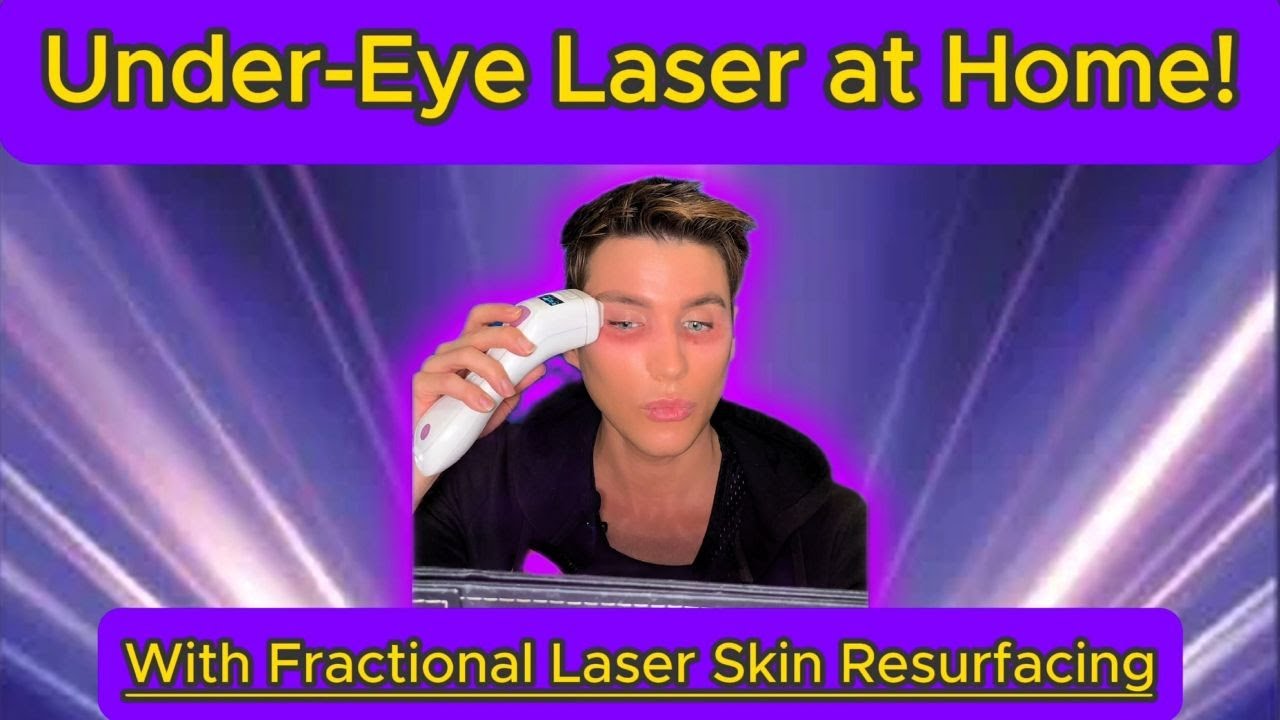I Used a Laser Under My Eyes at Home—Here’s What Happened #laserskinrejuvenation #fractionallaser