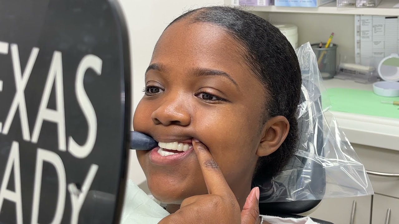 Houston Cosmetic Dentist...The most Amazing Snap-on Smile yet...And her reaction is priceless!